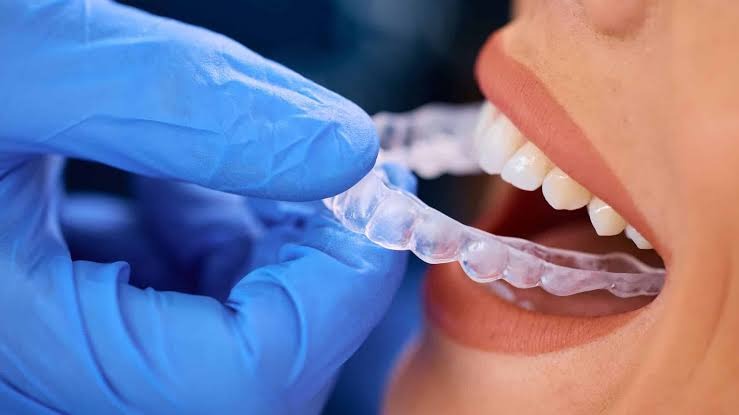 Invisalign dentist in Agoura Hills
